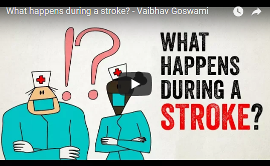 What happens during a stroke? – Vaibhav Goswami, TED-Ed