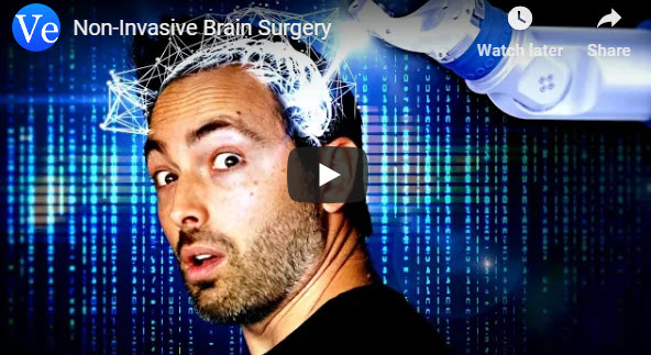 Non-Invasive Brain Surgery