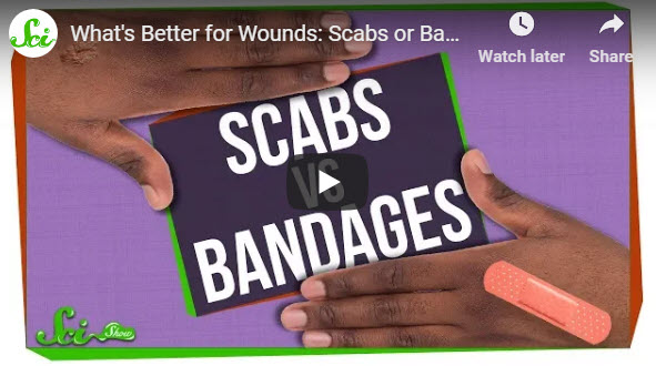 What’s Better for Wounds: Scabs or Bandages? – YouTube